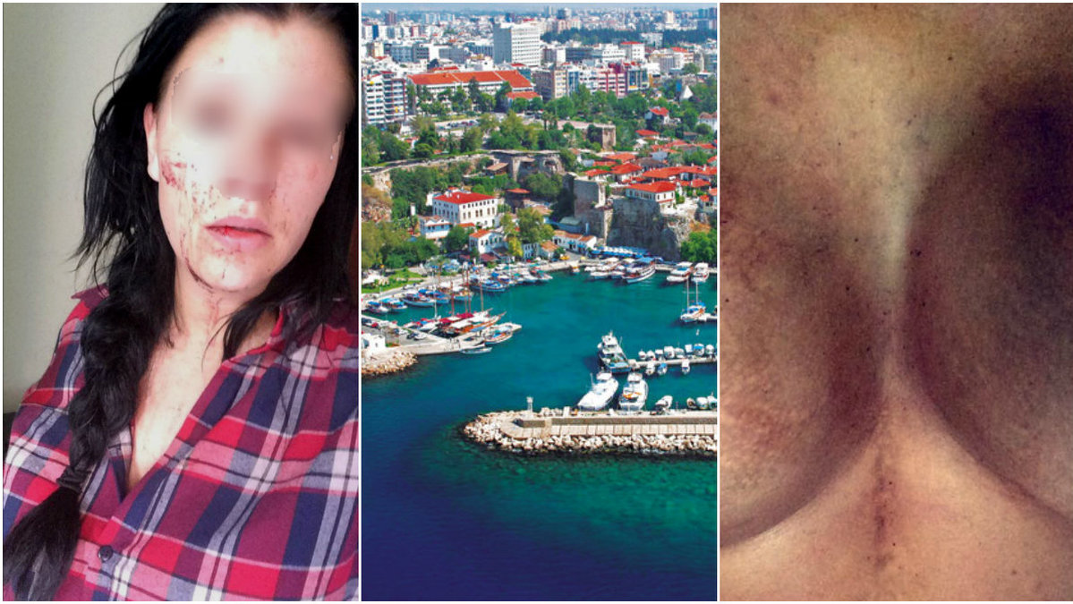 Enligt Elin blev hon misshandlad av sin pojkvän under resan till Antalya i Turkiet. Nu ska resebolaget Solresor se till att hon får komma hem trots att hennes pass enligt henne har blivit stulet.