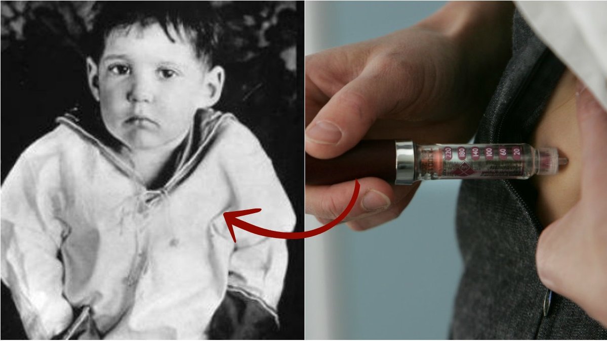 För 95 år sen behandlades den första patienten med insulin.