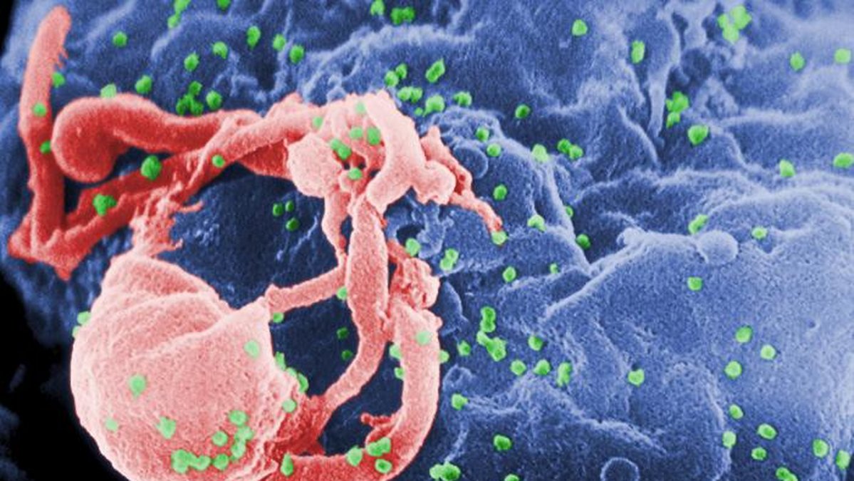 Hiv-viruset har botats hos ett barn - nu hoppas forskarna ha hittat ett botemedel.