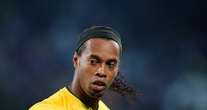Ronaldinho, Tänder, Atletico Mineiro, Brasilien, Skönhetsoperationer