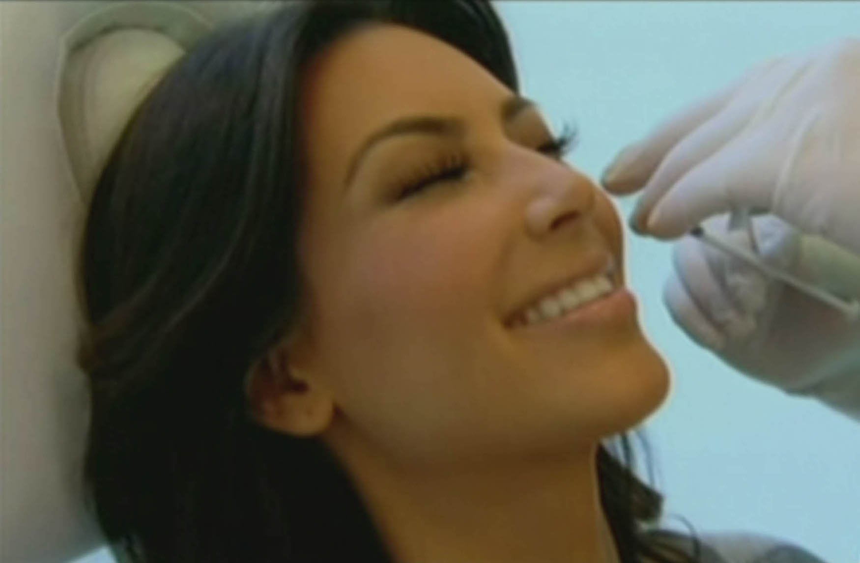 Sedan började Kim med Botox och fillers. Sedan började Kim med Botox och fillers.