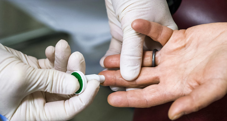 mjälleksem i ansiktet hiv