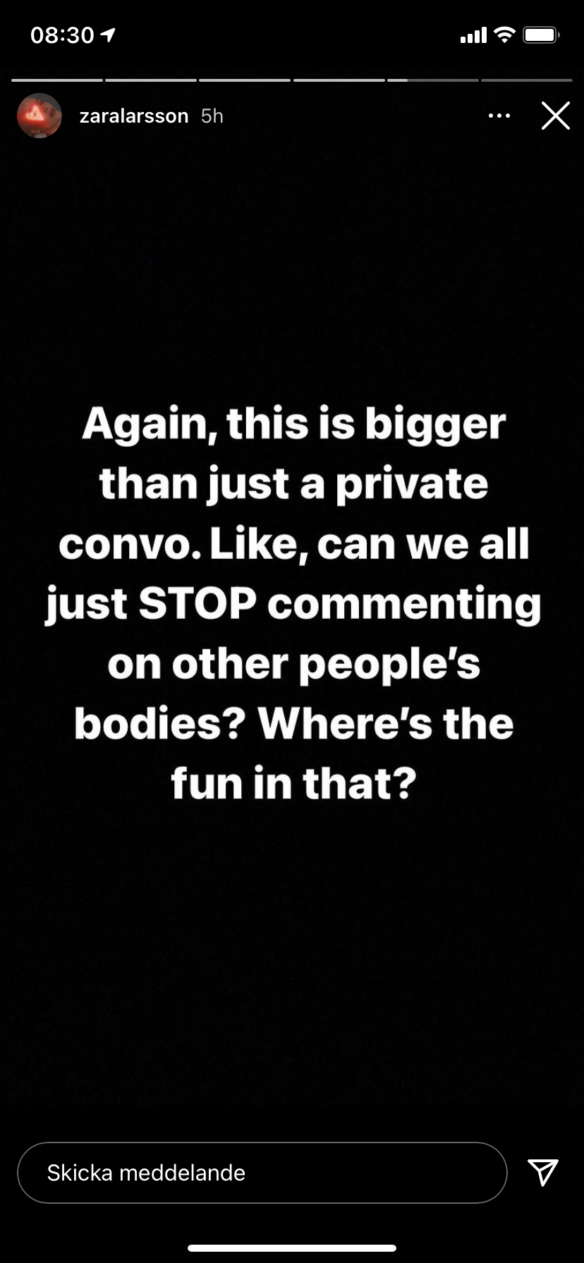 Här blir Zara Larsson utsatt för Body-shaming - av medarbetare