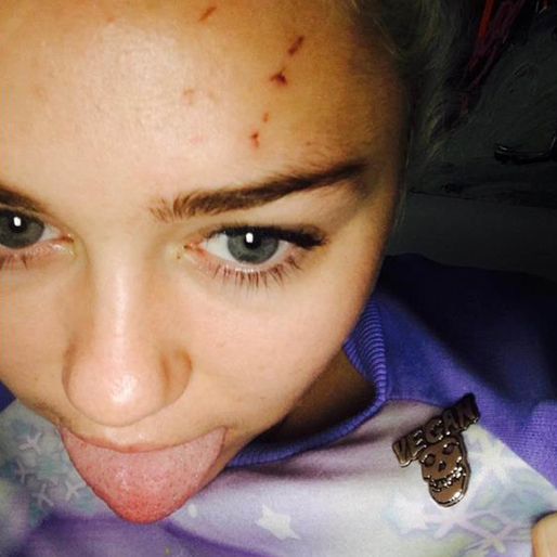 Miley Cyrus katt har rivit henne rejält. Miley Cyrus katt har rivit henne rejält.