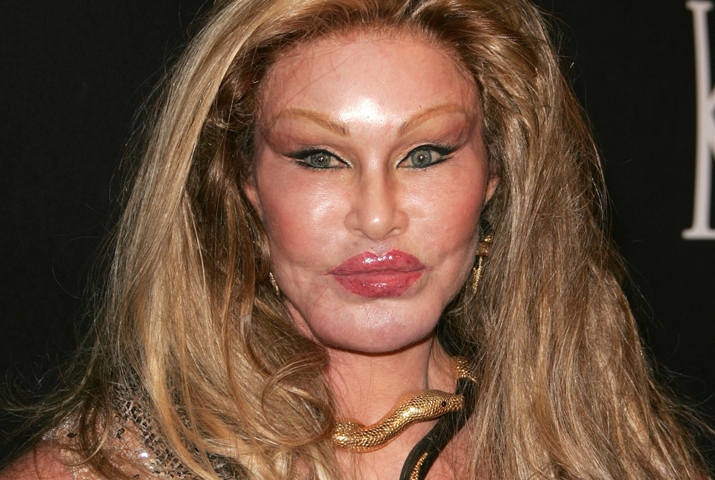 Societetskvinnan Jocelyn Wildenstein började operera sig för att likna en katt eftersom hennes dåvarande make gillade stora katter. Societetskvinnan Jocelyn Wildenstein började operera sig för att likna en katt eftersom hennes dåvarande make gillade stora katter.