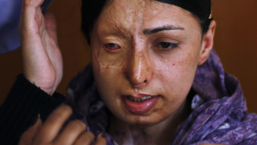 Även 26-åriga Somi Khalid har fått lida efter en attack. 