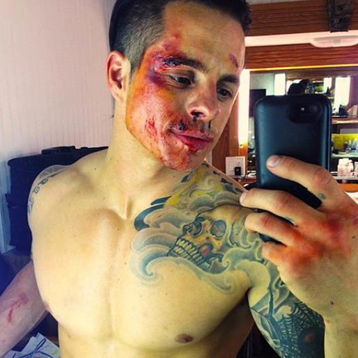 Casper Smart är blodig. Casper Smart är blodig.